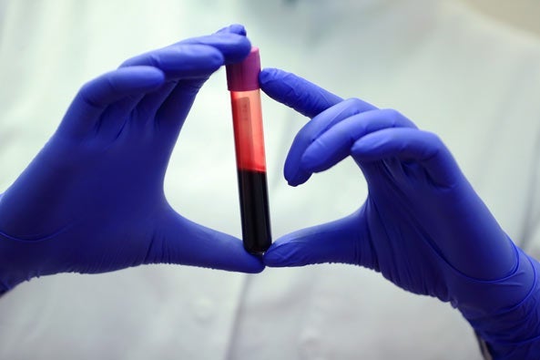 Gloved hands holding vial of blood